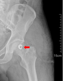 患者术后影像检查结果 患者术后影像检查结果